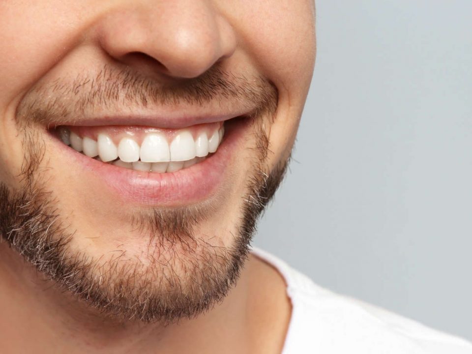 Bhandal Dental Practice Teeth Whitening West Midlands